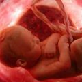 Defesa da Vida – Diga não ao Aborto