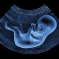Posição da CNBB em defesa incondicional da vida humana e contra o aborto